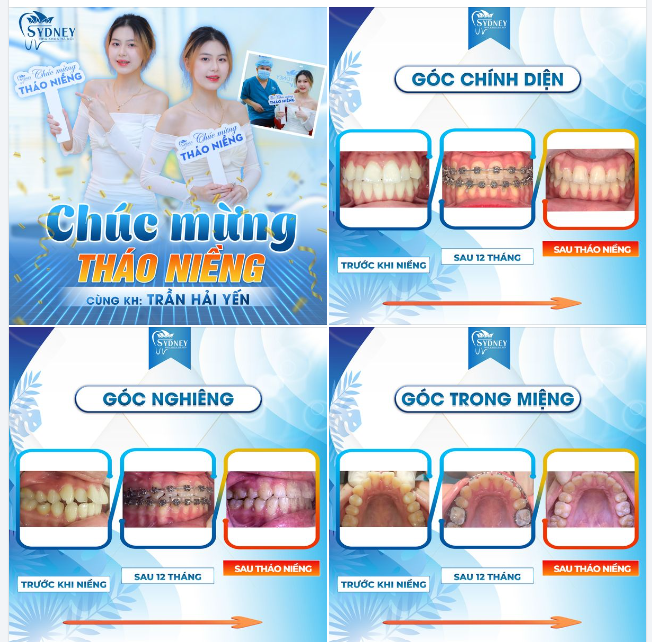 CHÚC MỪNG THÁO NIỀNG KH. HẢI YẾN