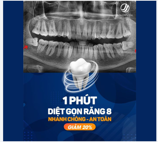 Trải Nghiệm Nhổ Răng 8 Tại Nha Khoa Jundental – Dịch Vụ Chất Lượng, An Tâm Tuyệt Đối!