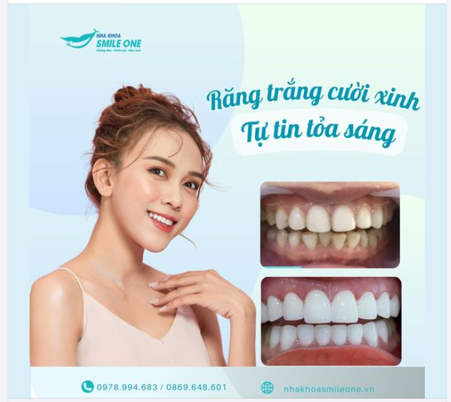 Bạn có cảm thấy ngại ngùng khi cười vì hàm răng không trắng sáng? Nụ cười kém tự tin có thể khiến bạn bỏ lỡ nhiều cơ hội trong cuộc sống và công việc.
