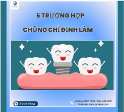 6 Trường hợp chống chỉ định khi làm implant