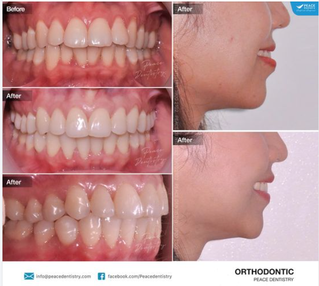 NHỮNG ĐIỀU TỐT ĐẸP THÌ LUÔN CẦN THỜI GIAN