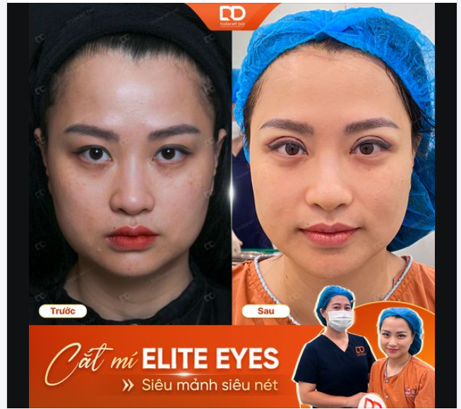 CẮT MÍ ELITE EYES - THANH MẢNH NHƯNG SẮC NÉT ĐẾN BẤT NGỜ