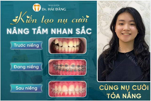 Kiến tạo nụ cười nâng tầm nhan sắc