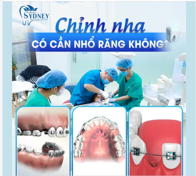 CHỈNH NHA CÓ CẦN NHỔ RĂNG KHÔNG?