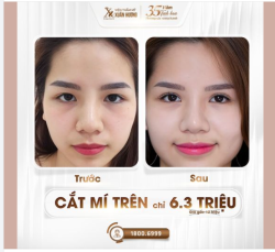 SIÊU SALE NGÀY VÀNG - CẮT MÍ TRÊN CHỈ 6,3 TRIỆU