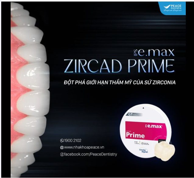 IPS E.MAX ZIRCAD PRIME – SỰ LỰA CHỌN HOÀN HẢO CHO NỤ CƯỜI HOÀN HẢO