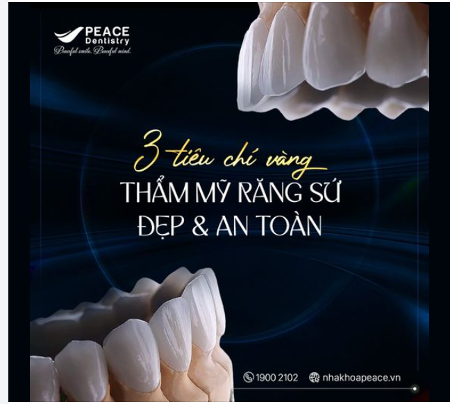 THẨM MỸ RĂNG SỨ ĐẸP  AN TOÀN  3 YẾU TỐ QUYẾT ĐỊNH THÀNH CÔNG