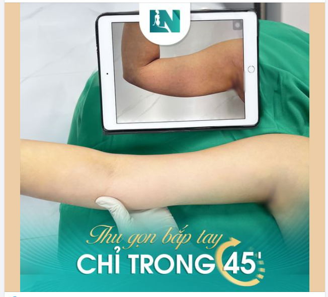 ĐÁNH BAY SẠCH MỠ TAY - ƯU ĐÃI LÊN ĐẾN 20%