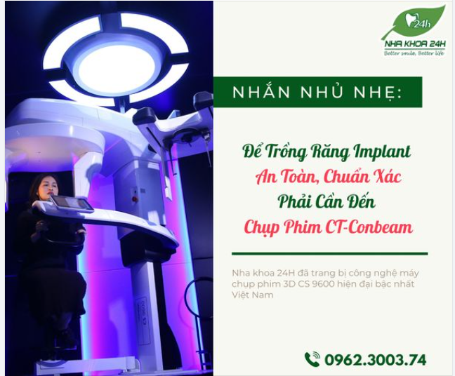 ĐỂ TRỒNG RĂNG IMPLANT AN TOÀN, CHUẨN XÁC - PHẢI CẦN ĐẾN CHỤP PHIM CT CONE BEAM!