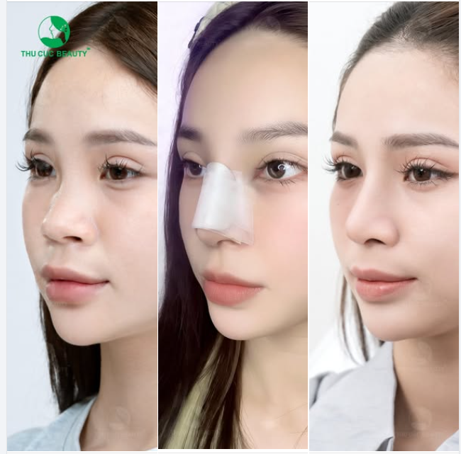  KH tại Thu Cuc sở hữu visual ưng ý sau 30P