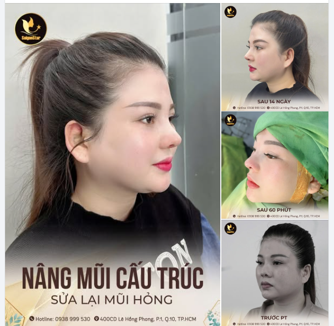 DÁNG MŨI QUYẾT ĐỊNH 70% THẦN THÁI VÀ SỰ TỰ TIN!!!