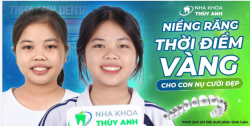 ĐẦU TƯ NIỀNG RĂNG SỚM, KHỞI ĐẦU CHO NỤ CƯỜI HOÀN HẢO Ở TUỔI THIẾU NIÊN