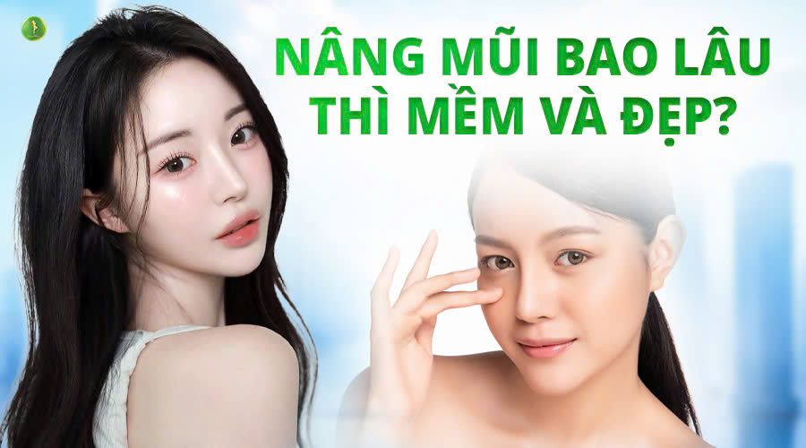 NÂNG MŨI BAO LÂU THÌ MỀM VÀ ĐẸP?