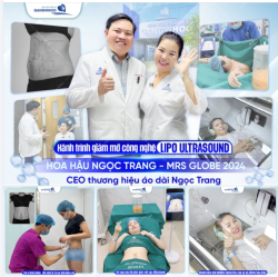 HÀNH TRÌNH GIẢM MỠ CỦA HOA HẬU NGỌC TRANG TẠI BVTM GANGWHOO