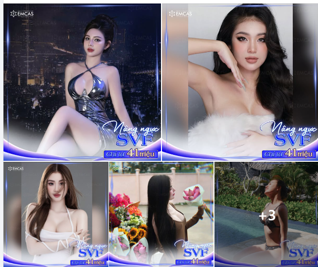 Nâng ngực SVF CHUẨN Y KHOA chỉ từ 41 Triệu