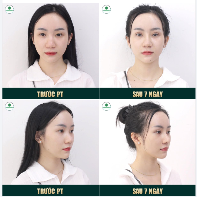 NOEL NÀY TẶNG CHỊ EM COMBO THĂNG HẠNG NHAN SẮC