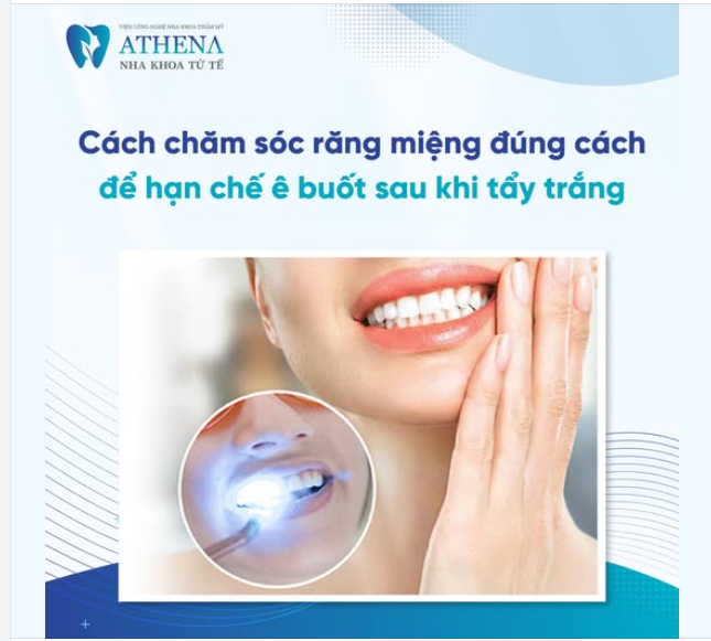 Cách chăm sóc răng miệng sau tẩy trắng