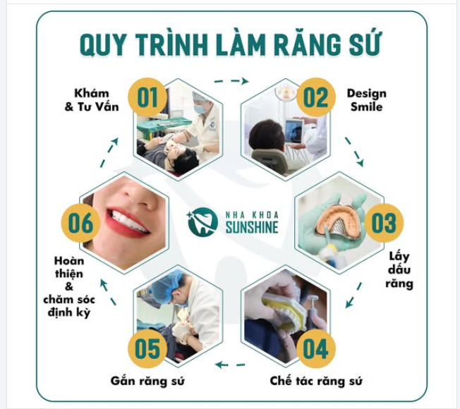 QUY TRÌNH 6 BƯỚC THẨM MỸ RĂNG SỨ TẠI NHA KHOA SUNSHINE