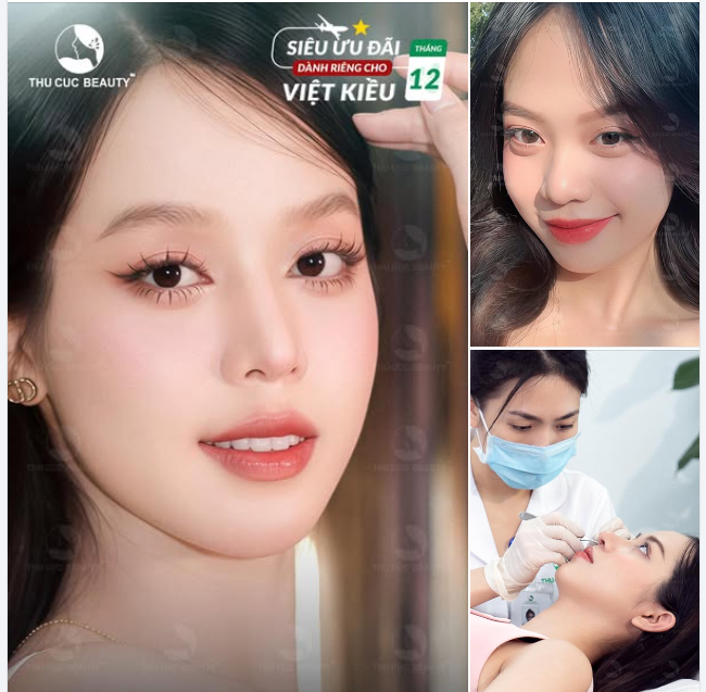 Tặng đến 5 chỉ vàng 9999 dành cho Việt Kiều nâng mũi