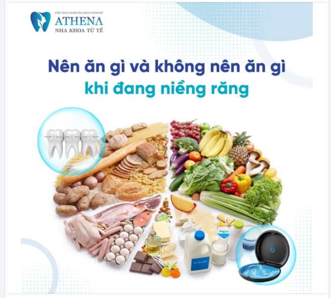 Nên ăn gì và không nên ăn gì khi niềng răng?