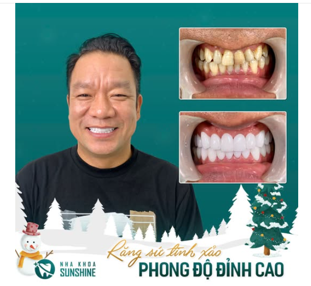 Ai bảo chỉ chị em phụ nữ mới ưa làm đẹp? Phái mạnh cũng cực kỳ quan tâm đến diện mạo của mình đấy.