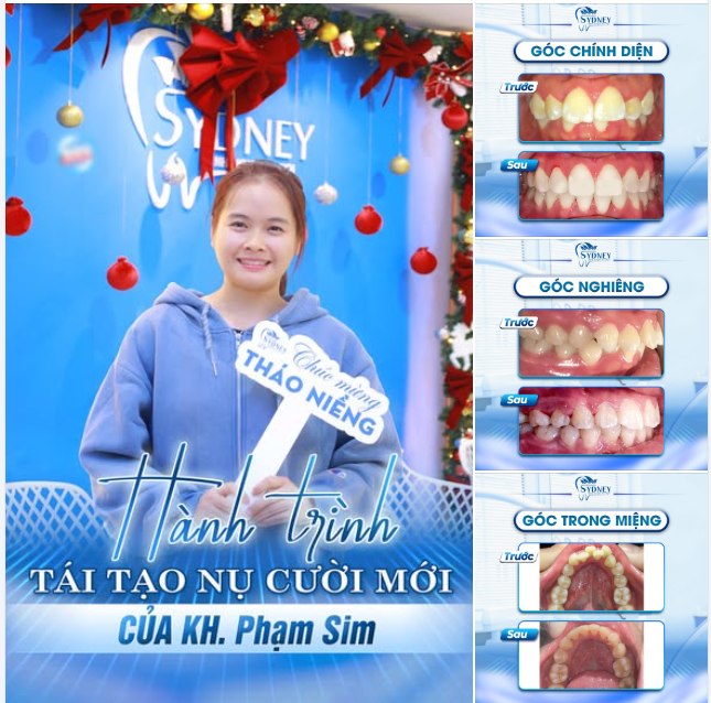 HÀNH TRÌNH TÁI TẠO NỤ CƯỜI MỚI CỦA KH. PHẠM SIM