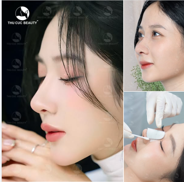 Nâng mũi TC  Kỹ thuật hiện đại mổ cảm biến mạch máu