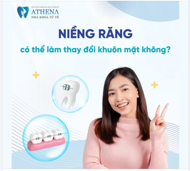 Niềng răng có làm thay đổi gương mặt?