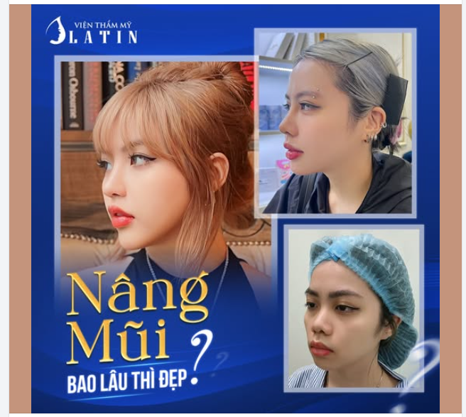 NÂNG MŨI BAO LÂU THÌ ĐẸP