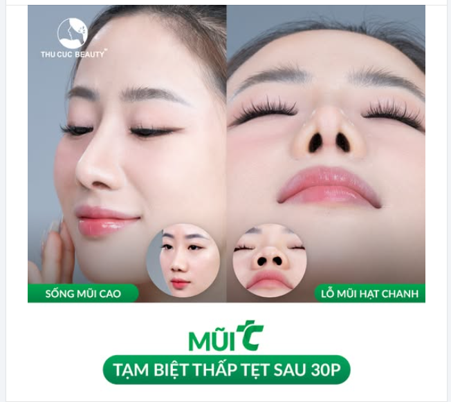 Đây có phải dáng mũi trong truyền thuyết mà chị em vẫn hay nhắc tới