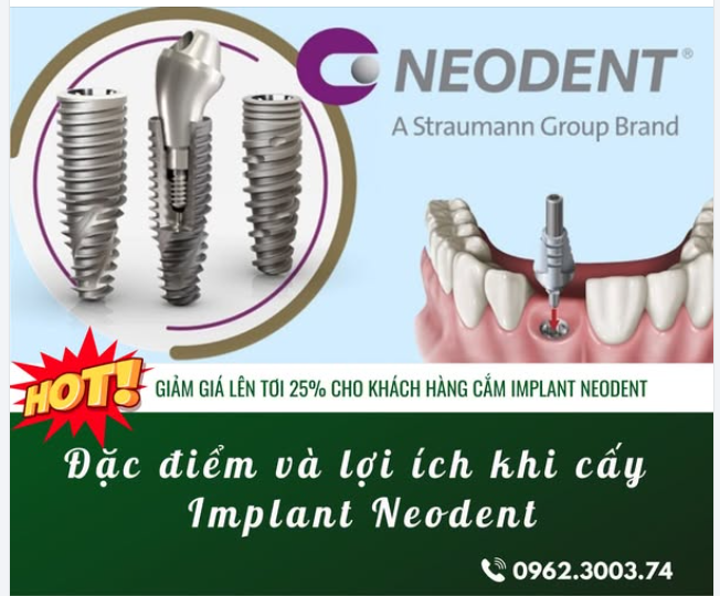 Đặc Điểm Và Lợi Ích Khi Cấy Implant Neodent