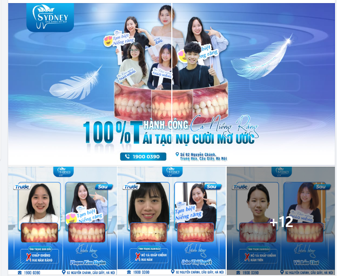 100% KHÁCH HÀNG THÁO NIỀNG RĂNG THÀNH CÔNG TẠI NHA KHOA HÀ NỘI SYDNEY