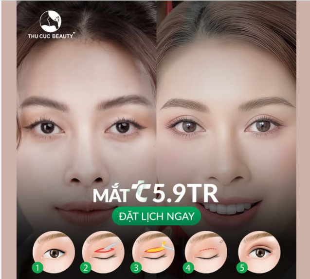Bác sĩ TC thiết kế dáng mí tự nhiên, hài hòa gương mặt từng khách hàng