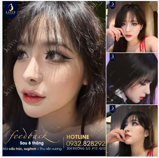 Khách nhà ai mà nâng mũi xong xinh xuất sắc như thế này vậy ạ!