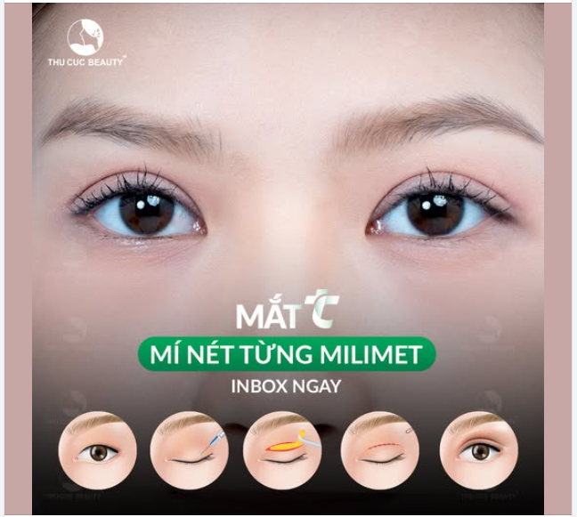 ​​​​​​​Cắt mí  Quy trình bài bản. Cơ sở vật chất chuẩn 5 sao