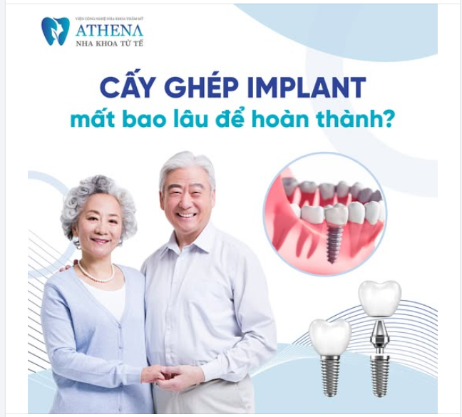 Cấy ghép Implant mất bao lâu?