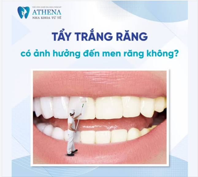 Tẩy trắng răng có ảnh hưởng đến men răng hay không?