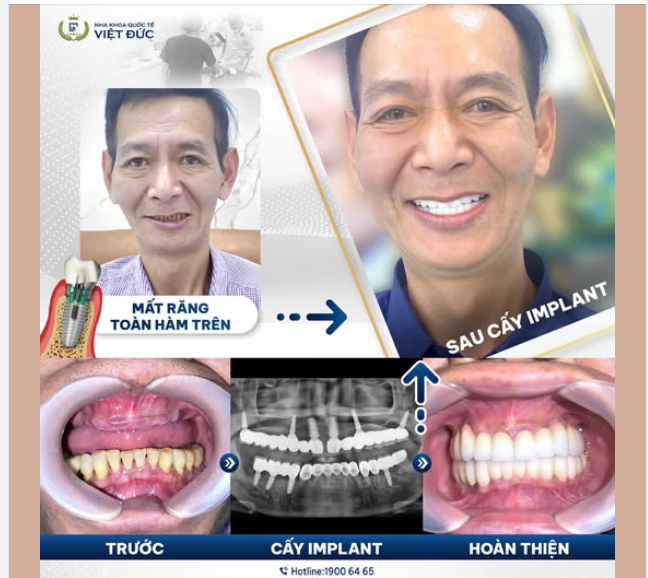 HÀNH TRÌNH TỪ SÉC VỀ VIỆT NAM TÌM LẠI NỤ CƯỜI VÀ SỨC KHỎE CỦA CHÚ LÊ THANH TÙNG