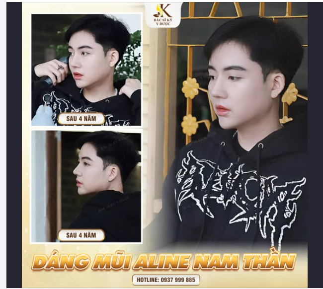 CHUYÊN MỤC FEEDBACK MŨI XINH