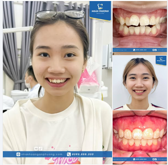 Tái sinh nụ cười cho cô gái Sài Gòn
