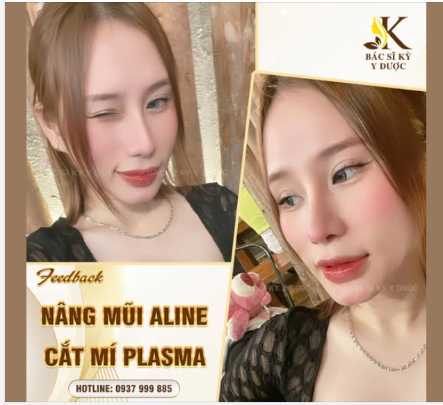 CHUYÊN MỤC FEEDBACK MŨI XINH