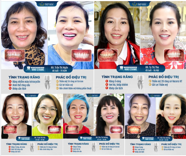 MỌI THAY ĐỔI ĐỀU XỨNG ĐÁNG
