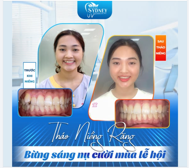 THÁO NIỀNG RĂNG - BỪNG SÁNG NỤ CƯỜI MÙA LỄ HỘI