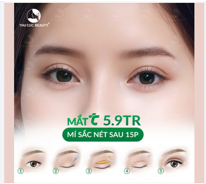 ​​​​​​​Cắt mí  Ứng dụng kỹ thuật hiện đại. Chỉ 15P thực hiện có ngay nếp mí sắc nét