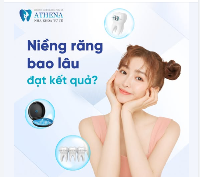 Thời gian niềng răng là bao lâu?