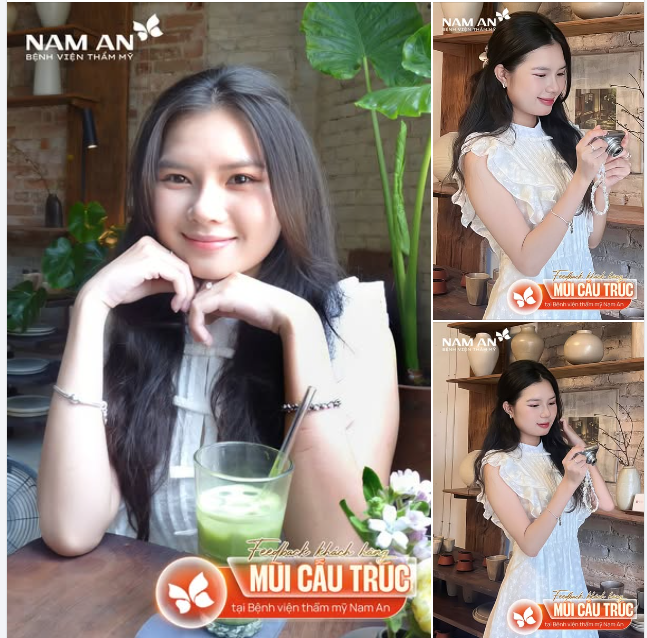 KHÁCH HÀNG XINH XẮN SAU NÂNG MŨI