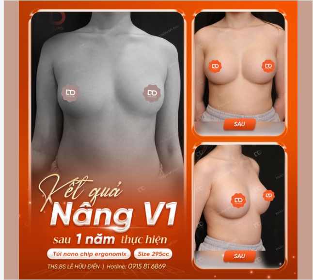 TỪ "CAU ĐIẾC" HOÁ "BƯỞI" CĂNG TRÒN  KẾT QUẢ NÂNG CẤP VÒNG 1 SAU 1 NĂM THỰC HIỆN