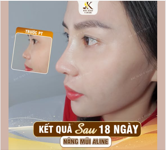TẤT BẬT LÀM ĐẸP CHO KHÁCH HÀNG ĐÓN TẾT