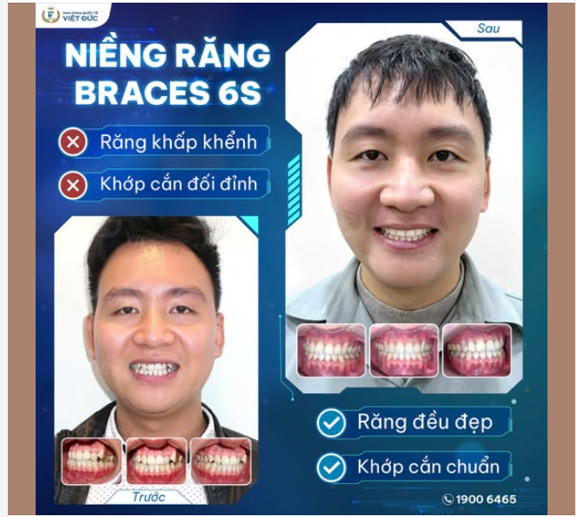 CHÚC MỪNG NGÀY THÁO NIỀNG CỦA ANH NGUYỄN ĐỨC TRUNG!