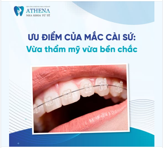 Bạn đang tìm kiếm một giải pháp chỉnh nha vừa hiệu quả vừa đảm bảo tính thẩm mỹ? Niềng răng mắc cài sứ chính là sự lựa chọn hoàn hảo, với những ưu điểm vượt trội sau: